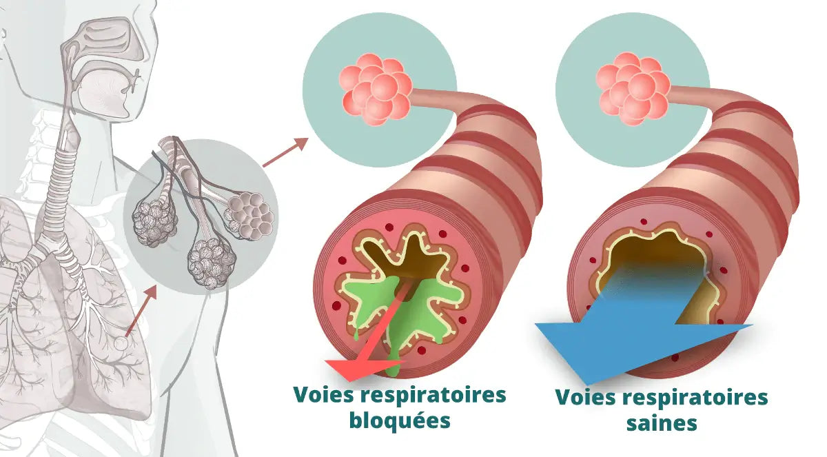 Avant après AirPhysio - voies respiratoires